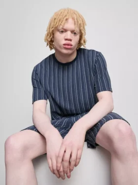 Raidallinen pyjaman yläosa